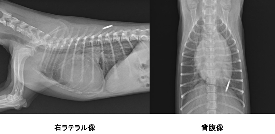 動脈管開存症の症例01 画像1