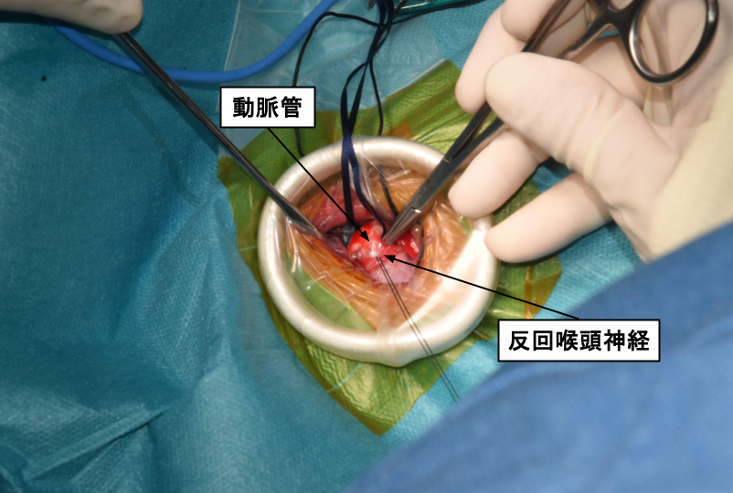 動脈管開存症の症例01 画像3